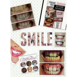 Teeth whitening