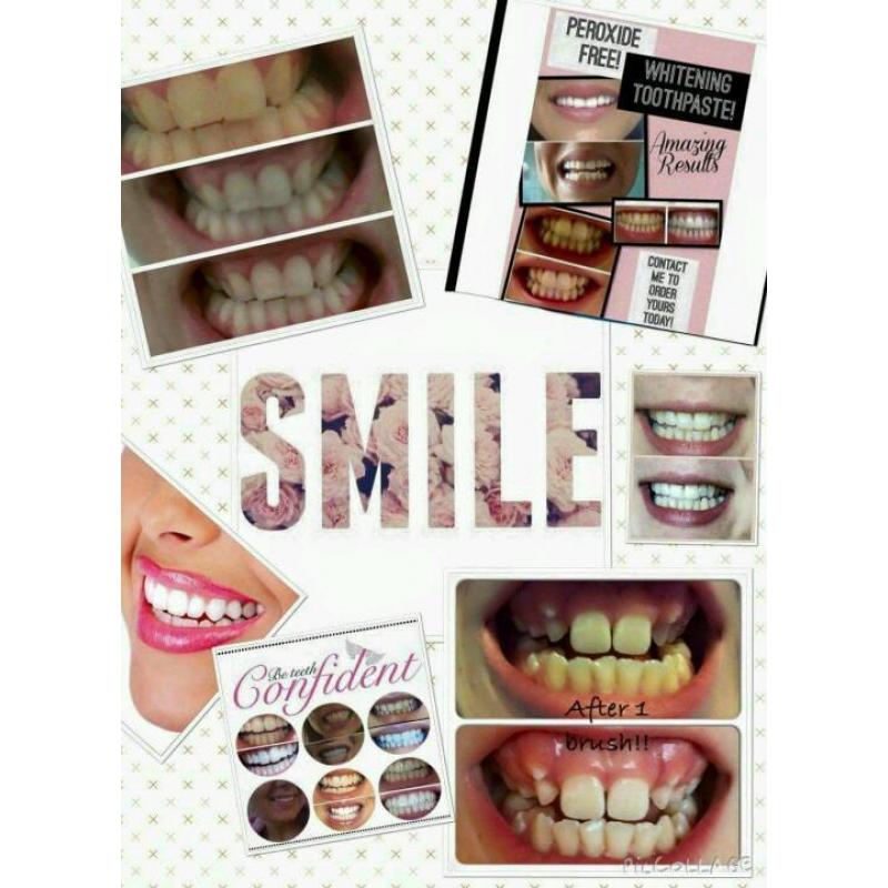 Teeth whitening